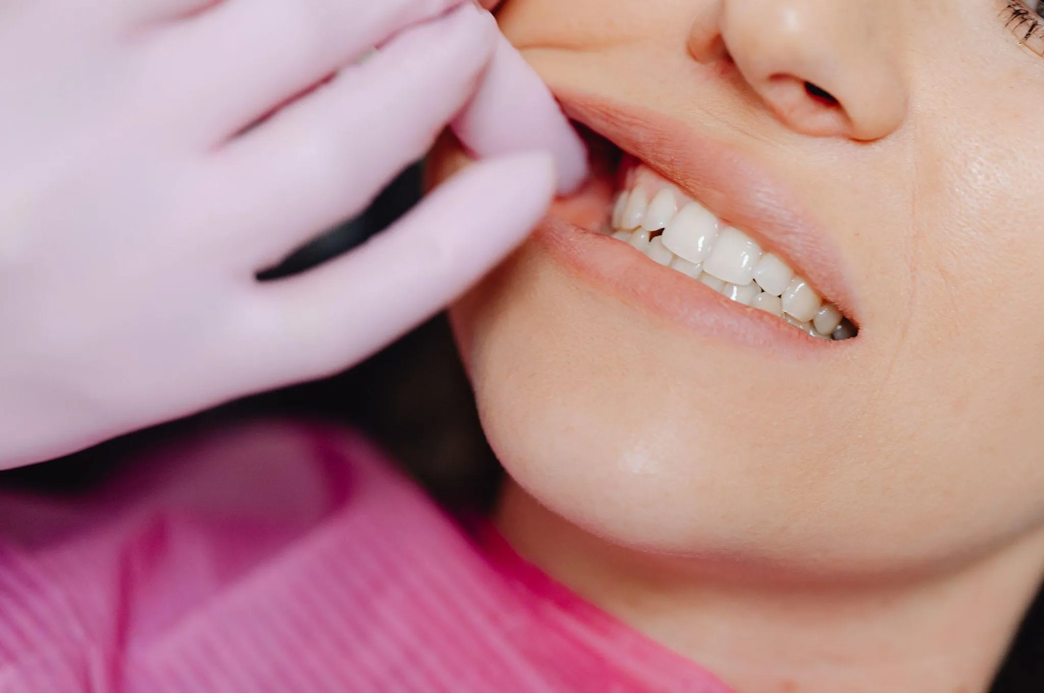 そもそも親知らずとは