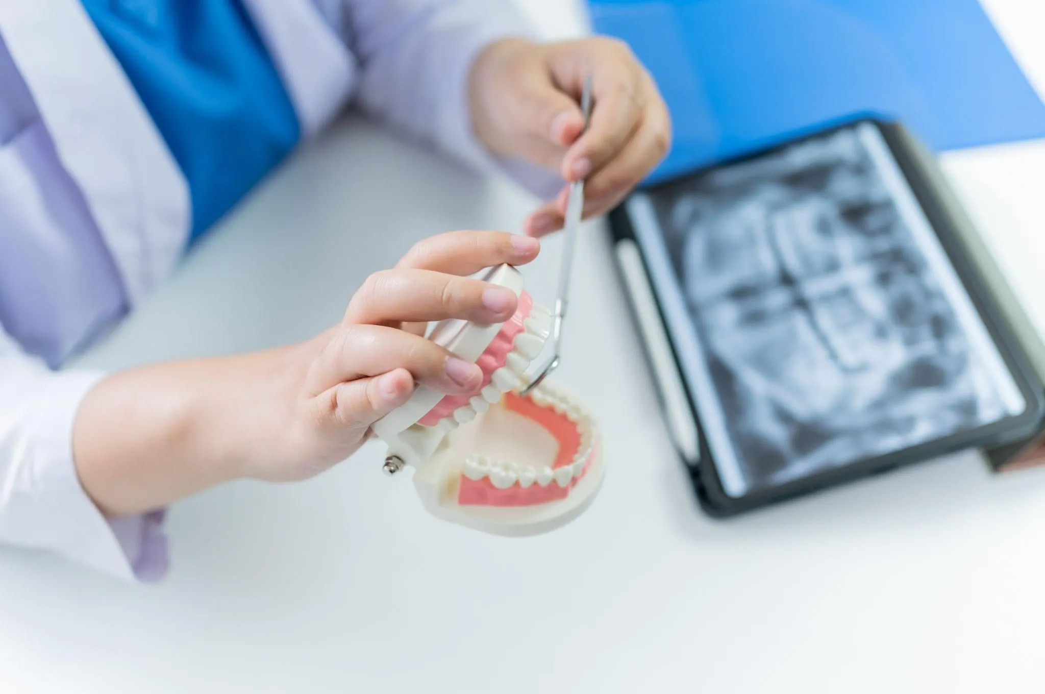 根管治療で膿を出す方法は？治療方法や治療期間について解説