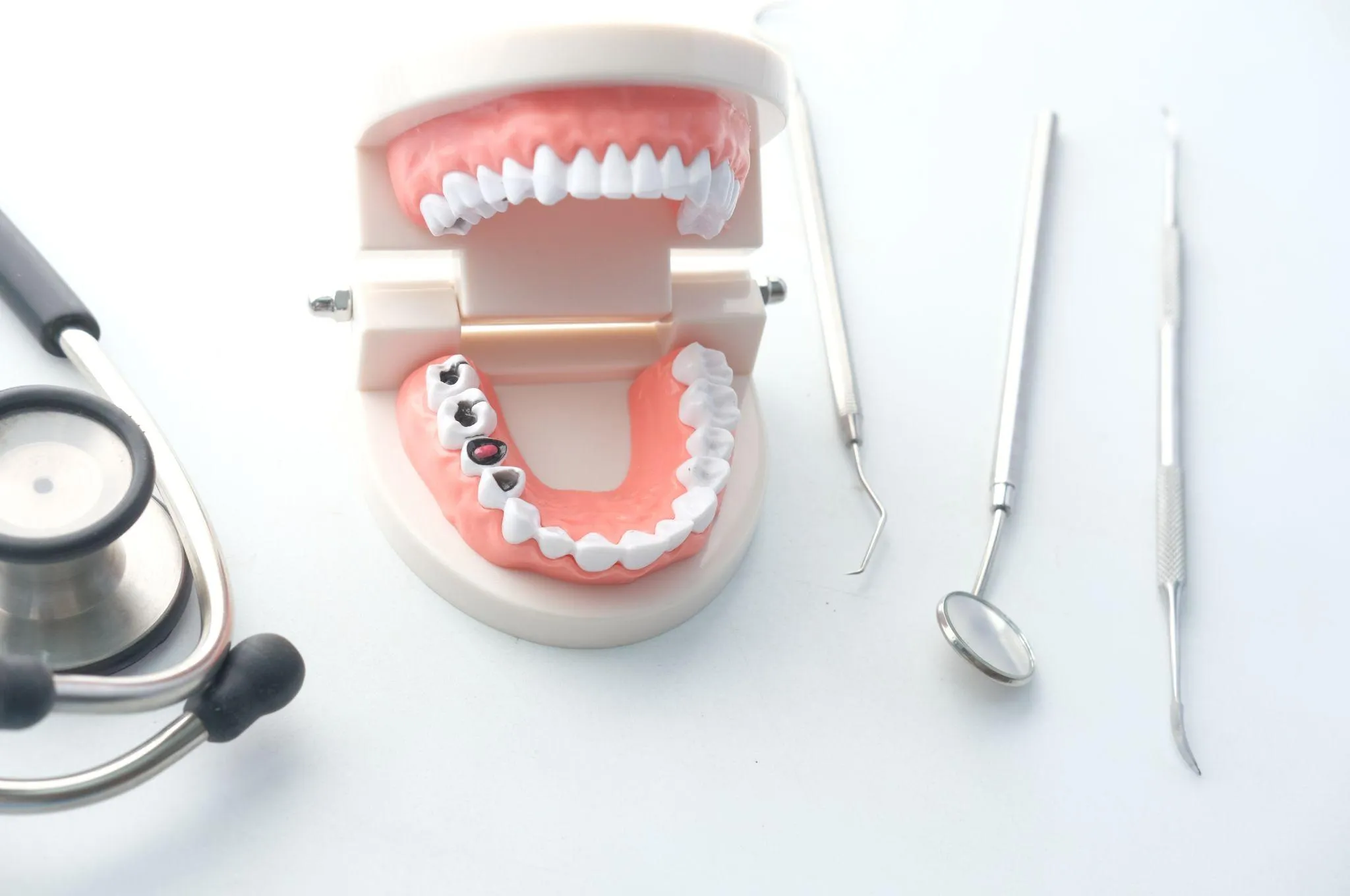 根管治療の流れ