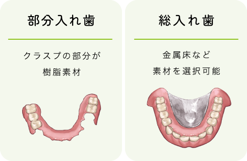 入れ歯｜治療について｜箕面市の歯科・歯医者 箕面おとなこども歯科